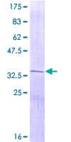 Human Osteocalcin Protein (Recombinant GST)