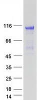 Human FGFR2 / FGF Receptor 2 Protein (Recombinant Myc-DDK (Flag))