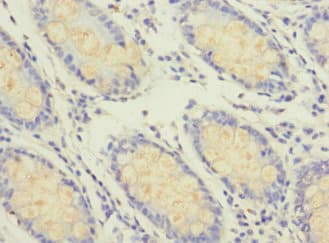 Polyclonal Rabbit anti-Human GFM2 Antibody (IHC)