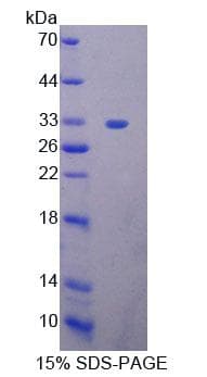 Mouse HMG20B / BRAF35 Protein (Recombinant His-T7, N-terminus)