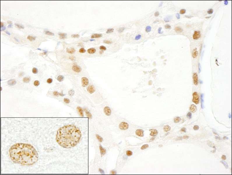 LUC7L3 / CROP Antibody (aa1-50)
