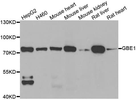 GBE1 Antibody