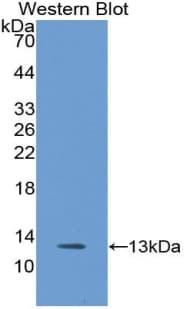 VCAM1 / CD106 Antibody (aa1-81, Biotin)