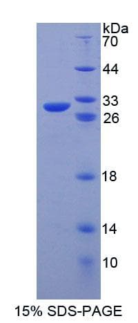 Mouse ABCB4 / MDR3 Protein (Recombinant His-T7, N-terminus)