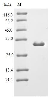 Rhesus monkey IL-10 Protein (Recombinant 6His-B2M, N-terminus)