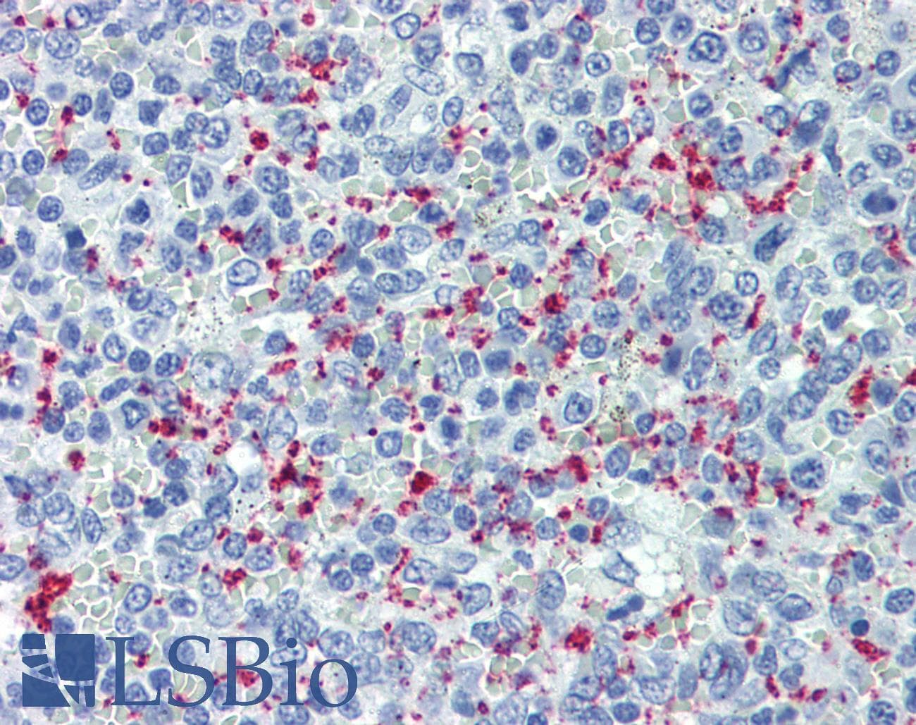 IHC-plus™ SELP / P-Selectin / CD62P Antibody (clone Psel.KO.2.5)
