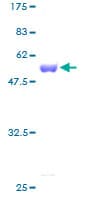 Human PMM2 Protein (Recombinant GST)