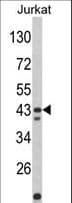 CECR5 Antibody (aa164-190)