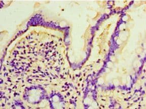 ARL4D Antibody