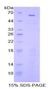 Mouse NES / Nestin Protein (Recombinant His-GST)
