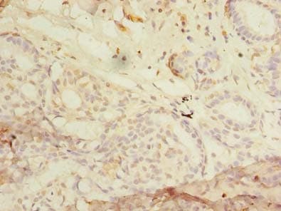 Polyclonal Rabbit anti-Human RHOC Antibody (IHC)
