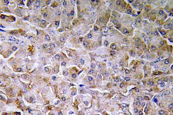 SEMA3C / Semaphorin 3C Antibody (Glu750)