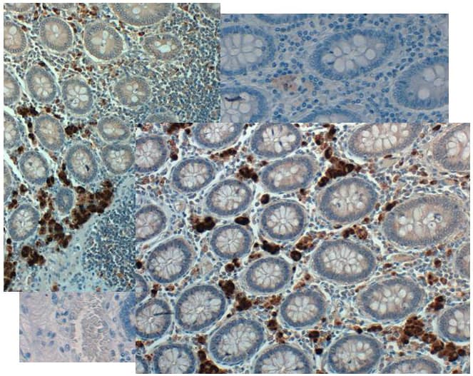 Polyclonal Rabbit anti-Human GDF15 Antibody (IHC, WB)