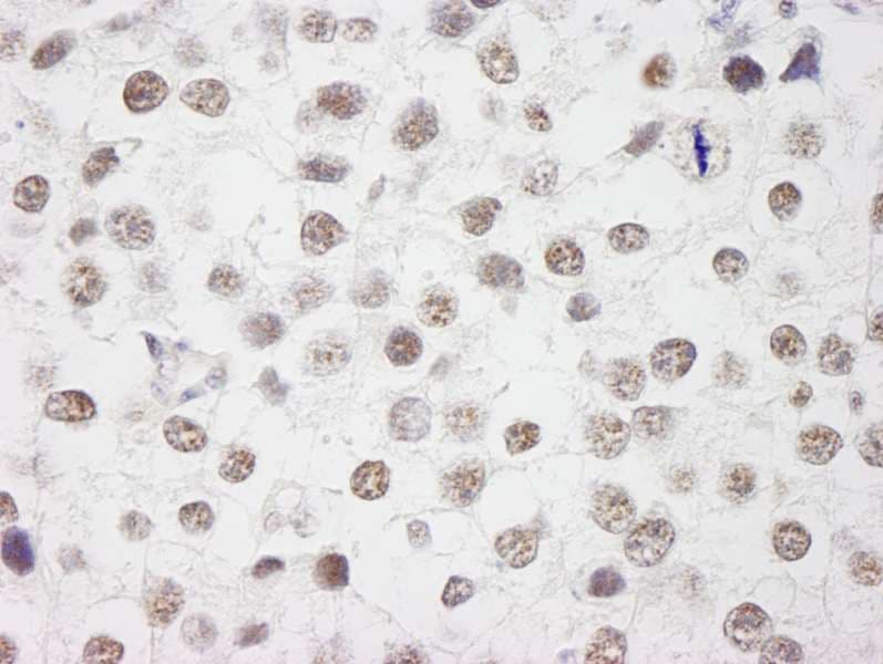 Polyclonal Rabbit anti-Human WTAP Antibody (aa346-396, IHC, WB)