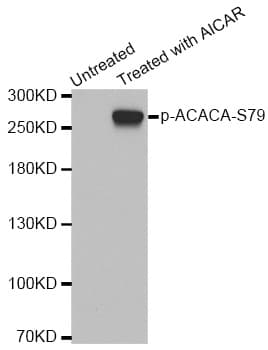 Polyclonal Rabbit anti-Human Acetyl-CoA Carboxylase / ACC Antibody (phospho-Ser79, WB)