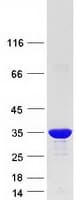 Human CACYBP Protein (Recombinant Myc-DDK (Flag))