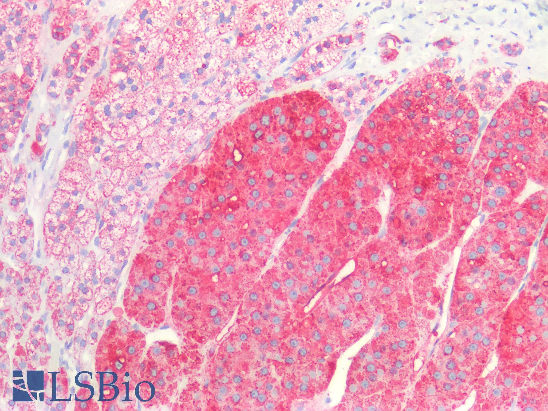IHC-plus™ Polyclonal Rabbit anti-Human HSPD1 / HSP60 Antibody (IHC, WB)