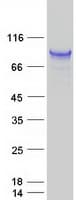 Human NFATC1 / NFAT2 Protein (Recombinant Myc-DDK (Flag))