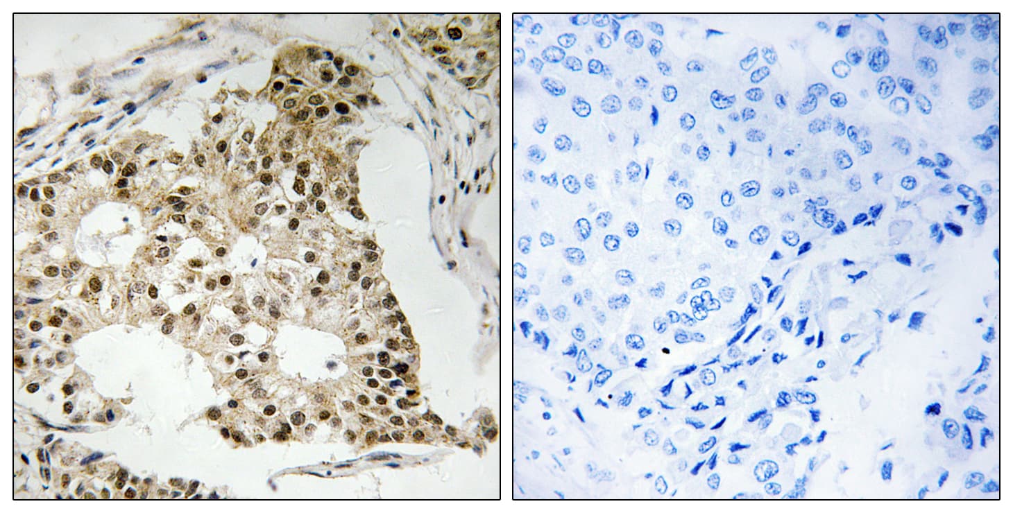 RARA / RAR Alpha Antibody (phospho-Ser77)