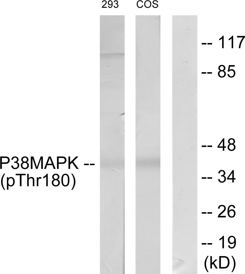 Polyclonal Rabbit anti-Human MAPK14 / p38 Antibody (phospho-Thr180, WB)