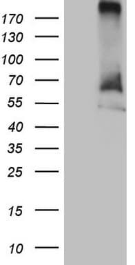 RORC / ROR Gamma Antibody (aa1-266, clone OTI1G3)