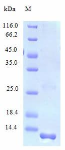 Human CCL21 / SLC Protein (Recombinant)