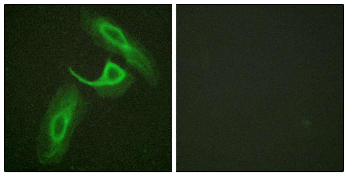 Polyclonal Rabbit anti-Human ITGB2 / CD18 Antibody (IF)