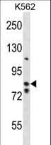 BACH2 Antibody (aa283-312)