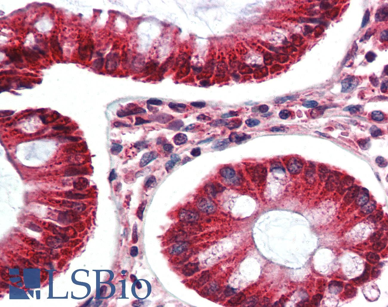IHC-plus™ Polyclonal Rabbit anti-Human BAK1 / BAK Antibody (N-Terminus, IHC)