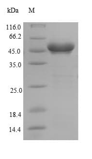 Human GSTK1 Protein (Recombinant 6His-SUMO, N-terminus)
