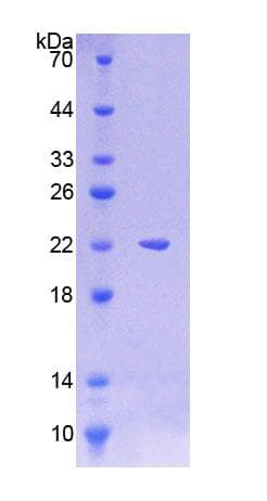 Human LAMP3 / CD208 Protein (Recombinant His-T7)