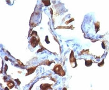 KRT8 / CK8 / Cytokeratin 8 Antibody (clone KRT8/803, Ready-to-Use)