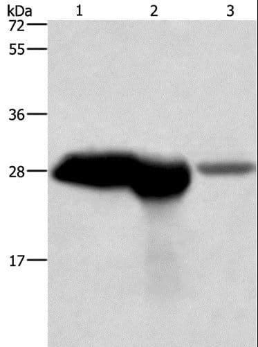 Polyclonal Rabbit anti-Human CALB1 / Calbindin Antibody (IHC, WB)
