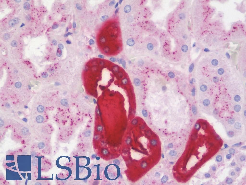 PathPlus™ Polyclonal Rabbit anti-Human UMOD / Uromodulin Antibody (Val378, IHC, WB)