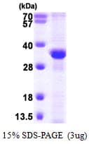 Human RPA2 / RFA2 / RPA34 Protein (Recombinant His)