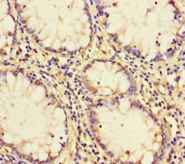Polyclonal Rabbit anti-Human PCF11 Antibody (IHC)