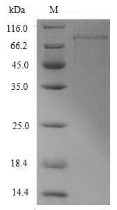 Escherichia coli dnaK Protein (Recombinant 6His, N-terminus)