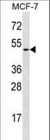 LAD1 Antibody (aa143-172)