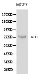 NF-L / NEFL Antibody