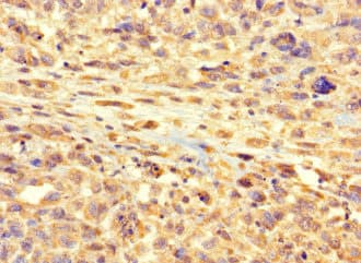 RSPH9 / C6orf206 Antibody