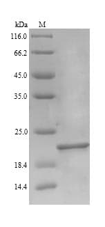 Escherichia coli EF-P Protein (Recombinant 6His, N-terminus)