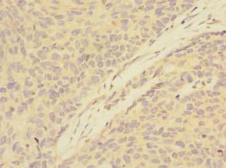 Polyclonal Rabbit anti-Human ATXN10 / SCA10 Antibody (IHC, WB)
