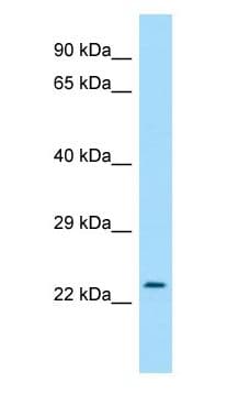 Polyclonal Rabbit anti-Human RAB30 Antibody (aa128-177, WB)