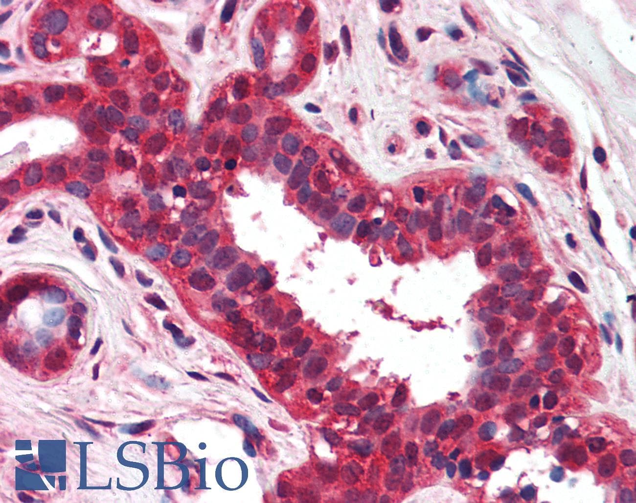 IHC-plus™ NKIRAS1 Antibody (aa96-113, clone 184C278)