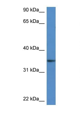DHRS3 / SDR1 Antibody (aa210-259)