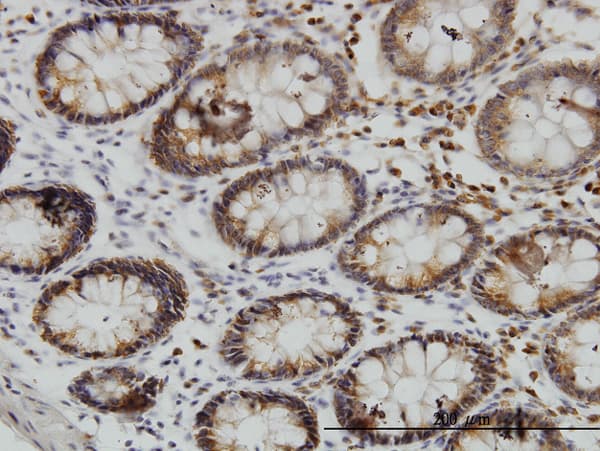 SGK3 Antibody (clone 2A7)