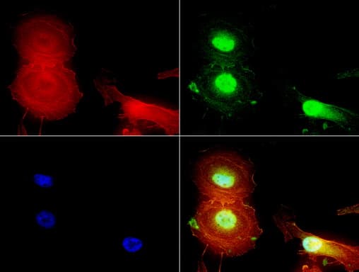 JUN / c-Jun Antibody (clone UMAB67)