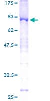 Human SYT1 / Synaptotagmin Protein (Recombinant GST)