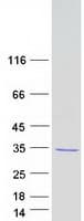 Human REEP4 Protein (Recombinant Myc-DDK (Flag))