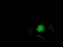 GSTT2 Antibody (clone OTI8A10)